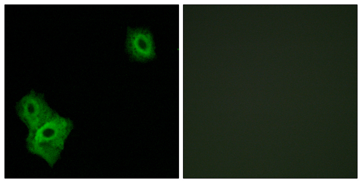 AIFM3 Antibody - Immunofluorescence analysis of A549 cells, using AIFM3 Antibody. The picture on the right is blocked with the synthesized peptide.