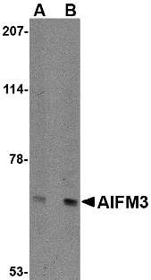AIFM3 Antibody - Western blot of NIPSNAP in human brain tissue lysate with NIPSNAP antibody at (A) 0.5 and (B) 1 ug/ml.