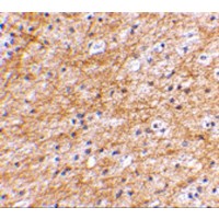 AIFM3 Antibody - Immunohistochemical staining of human brain tissue using AIFM3 antibody at 2.5 µg/mL.