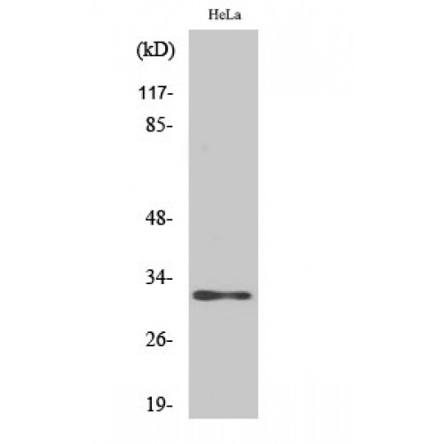 AIG1 Antibody - Western blot of AIG-1 antibody