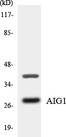 AIG1 Antibody - Western blot analysis of the lysates from HT-29 cells using AIG1 antibody.