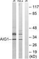 AIG1 Antibody - Western blot analysis of lysates from HeLa and Jurkat cells, using AIG1 Antibody. The lane on the right is blocked with the synthesized peptide.