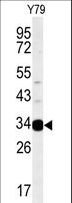 AIG1 Antibody - Western blot of AIG1 Antibody in Y79 cell line lysates (35 ug/lane). AIG1 (arrow) was detected using the purified antibody.