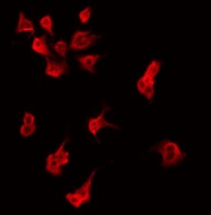 AIG1 Antibody - Staining HeLa cells by IF/ICC. The samples were fixed with PFA and permeabilized in 0.1% Triton X-100, then blocked in 10% serum for 45 min at 25°C. The primary antibody was diluted at 1:200 and incubated with the sample for 1 hour at 37°C. An Alexa Fluor 594 conjugated goat anti-rabbit IgG (H+L) Ab, diluted at 1/600, was used as the secondary antibody.