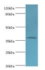 AIM / CD5L Antibody - Western blot. All lanes: CD5L antibody at 3 ug/ml+A431 whole cell lysate. Secondary antibody: Goat polyclonal to rabbit at 1:10000 dilution. Predicted band size: 38 kDa. Observed band size: 38 kDa.