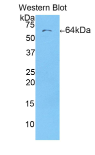 AIM / CD5L Antibody - Western blot of recombinant AIM / CD5L.  This image was taken for the unconjugated form of this product. Other forms have not been tested.