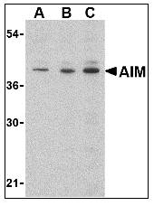 AIM / CD5L Antibody - Western blot of AIM in Raji lysate with AIM Antibody at (A) 0.5, (B) 1 and (C) 2 ug/ml.