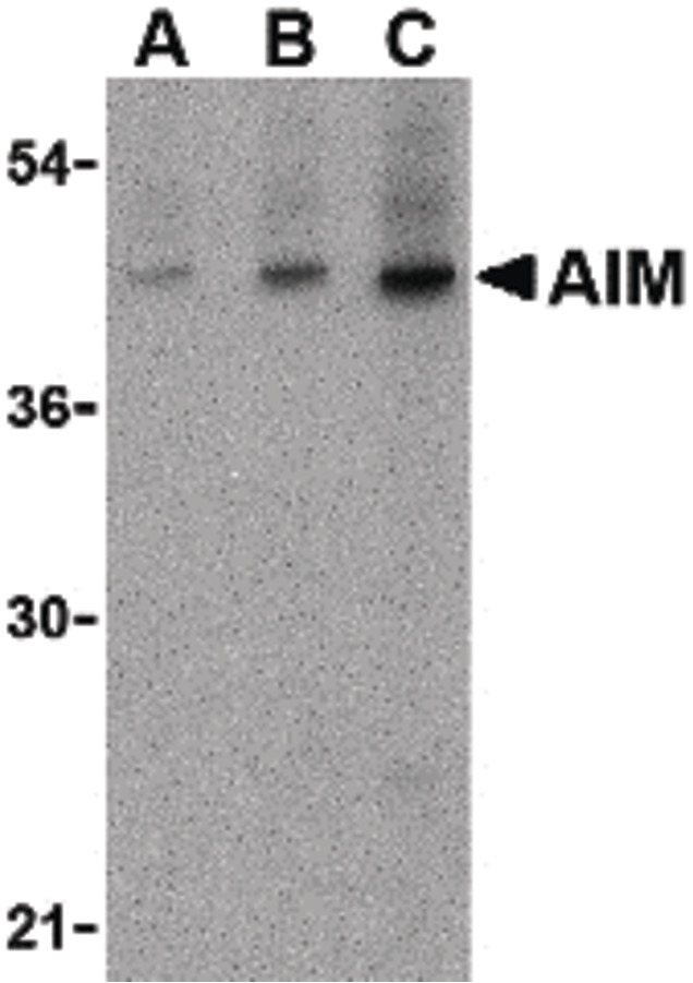 AIM / CD5L Antibody - Western blot of AIM in human lymph node tissue lysate with AIM antibody at (A) 1, (B) 2 and (C) 4 ug/ml.