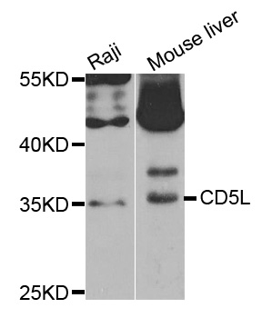 AIM / CD5L Antibody - Western blot analysis of extracts of various cell lines, using CD5L antibody.
