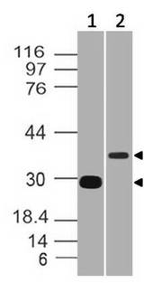 AIM / CD5L Antibody - Fig-3: Western blot analysis of CD5L. Anti CD5L was used at 0.5 µg/ml in Recombinant and 2 µg/ml in h spleen lysates.