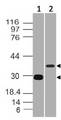 AIM / CD5L Antibody - Fig-3: Western blot analysis of CD5L. Anti CD5L was used at 0.5 µg/ml in Recombinant and 2 µg/ml in h spleen lysates.