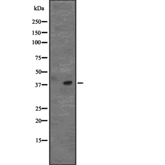AIM / CD5L Antibody - Western blot analysis of CD5L expression in Raji cells lysate. The lane on the left is treated with the antigen-specific peptide.