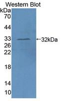 AIM1 Antibody - Western blot of AIM1 antibody using the recombinant protein used as the immunogen.