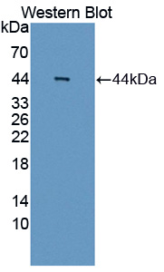 AIM2 Antibody - Western blot of AIM2 antibody.