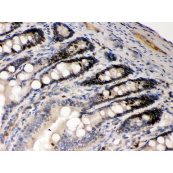 AIM2 Antibody - AIM2 antibody IHC-paraffin. IHC(P): Rat Intestine Tissue.
