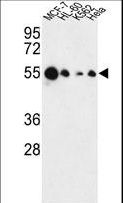 AIM2 Antibody - Western blot of AIM2 Antibody in MCF-7, HL-60, K562, HeLa cell line lysates (35 ug/lane). AIM2 (arrow) was detected using the purified antibody.
