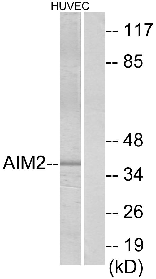 AIM2 Antibody - Western blot analysis of lysates from HUVEC cells, using AIM2 Antibody. The lane on the right is blocked with the synthesized peptide.