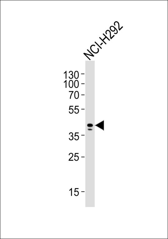 AIM2 Antibody - Western blot of lysate from NCI-H292 cell line, using AIM2 Antibody. Antibody was diluted at 1:1000. A goat anti-mouse IgG H&L (HRP) at 1:3000 dilution was used as the secondary antibody. Lysate at 20ug.