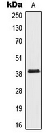 AIM2 Antibody - Western blot analysis of AIM2 expression in Jurkat (A) whole cell lysates.
