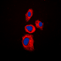 AIM2 Antibody - Immunofluorescent analysis of AIM2 staining in Jurkat cells. Formalin-fixed cells were permeabilized with 0.1% Triton X-100 in TBS for 5-10 minutes and blocked with 3% BSA-PBS for 30 minutes at room temperature. Cells were probed with the primary antibody in 3% BSA-PBS and incubated overnight at 4 C in a humidified chamber. Cells were washed with PBST and incubated with a DyLight 594-conjugated secondary antibody (red) in PBS at room temperature in the dark. DAPI was used to stain the cell nuclei (blue).