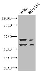 AIM2 Antibody - Positive WB detected in:K562 whole cell lysate,SH-SY5Y whole cell lysate;All lanes: AIM2 antibody at 2.7ug/ml;Secondary;Goat polyclonal to rabbit IgG at 1/50000 dilution;Predicted band size: 39 kDa;Observed band size: 39,45 kDa;