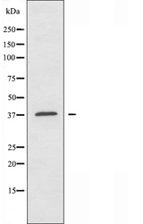 AIM2 Antibody - Western blot analysis of extracts of HuvEc cells using AIM2 antibody.