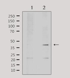 AIM2 Antibody - Western blot analysis of extracts of mouse brain tissue using AIM2 antibody. Lane 1 was treated with the antigen-specific peptide.