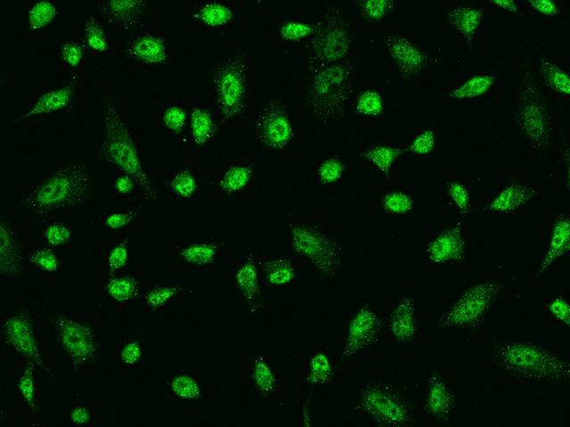 AIM2 Antibody - Immunofluorescence staining of AIM2 in HeLa cells. Cells were fixed with 4% PFA, permeabilzed with 0.1% Triton X-100 in PBS, blocked with 10% serum, and incubated with rabbit anti-Human AIM2 polyclonal antibody (dilution ratio 1:100) at 4°C overnight. Then cells were stained with the Alexa Fluor 488-conjugated Goat Anti-rabbit IgG secondary antibody (green). Positive staining was localized to Nucleus and Cytoplasm.