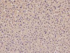 AIM2 Antibody - Immunochemical staining of human AIM2 in human liver with rabbit polyclonal antibody at 1:100 dilution, formalin-fixed paraffin embedded sections.