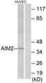 AIM2 Antibody - Western blot analysis of extracts from HUVEC cells, using AIM2 antibody.