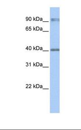 AIM2 Antibody - Fetal lung lysate. Antibody concentration: 1.0 ug/ml. Gel concentration: 12%.  This image was taken for the unconjugated form of this product. Other forms have not been tested.