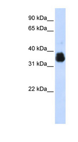 AIMP1 / EMAP II Antibody - AIMP1 / SCYE1 antibody Western blot of 293T cell lysate. This image was taken for the unconjugated form of this product. Other forms have not been tested.