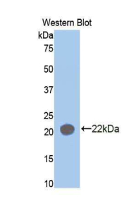 AIMP1 / EMAP II Antibody - Western blot of recombinant AIMP1 / EMAP II / p43.  This image was taken for the unconjugated form of this product. Other forms have not been tested.