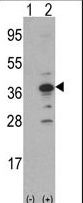 AIMP1 / EMAP II Antibody - Western blot of MCA1(arrow) using rabbit polyclonal MCA1 Antibody. 293 cell lysates (2 ug/lane) either nontransfected (Lane 1) or transiently transfected with the MCA1 gene (Lane 2) (Origene Technologies).