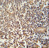 AIMP1 / EMAP II Antibody - MCA1 Antibody immunohistochemistry of formalin-fixed and paraffin-embedded human lymph node followed by peroxidase-conjugated secondary antibody and DAB staining.