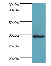 AIMP1 / EMAP II Antibody - Western blot. All lanes: Aminoacyl tRNA synthase complex-interacting multifunctional protein 1 antibody at 2 ug/ml+HepG2 whole cell lysate. Secondary antibody: Goat polyclonal to rabbit at 1:10000 dilution. Predicted band size: 34 kDa. Observed band size: 34 kDa.
