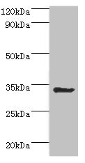 AIMP1 / EMAP II Antibody - Western blot All lanes: Aminoacyl tRNA synthase complex-interacting multifunctional protein 1 antibody at 2µg/ml + HepG2 whole cell lysate Secondary Goat polyclonal to rabbit IgG at 1/10000 dilution Predicted band size: 35, 38 kDa Observed band size: 35 kDa