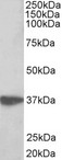 AIMP1 / EMAP II Antibody - AIMP1 antibody (0.3 ug/ml) staining of Jurkat lysate (35 ug protein in RIPA buffer). Primary incubation was 1 hour. Detected by chemiluminescence.