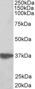 AIMP1 / EMAP II Antibody - AIMP1 antibody (0.3 ug/ml) staining of Jurkat lysate (35 ug protein in RIPA buffer). Primary incubation was 1 hour. Detected by chemiluminescence.