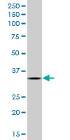 AIMP1 / EMAP II Antibody - SCYE1 monoclonal antibody (M05), clone 3H5. Western blot of SCYE1 expression in Jurkat.