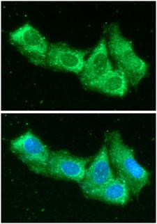 AIMP1 / EMAP II Antibody - ICC/IF analysis of AIMP1 in Hep3B cells line, stained with DAPI (Blue) for nucleus staining and monoclonal anti-human AIMP1 antibody (1:100) with goat anti-mouse IgG-Alexa fluor 488 conjugate (Green).