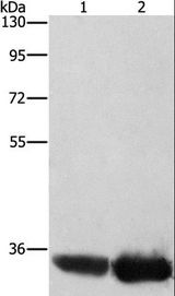 AIMP1 / EMAP II Antibody - Western blot analysis of HeLa and hepG2 cell, using AIMP1 Polyclonal Antibody at dilution of 1:400.