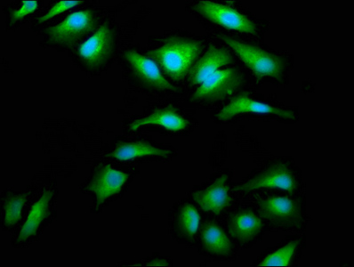 AIMP1 / EMAP II Antibody - Immunofluorescence staining of Hela cells at a dilution of 1:66, counter-stained with DAPI. The cells were fixed in 4% formaldehyde, permeabilized using 0.2% Triton X-100 and blocked in 10% normal Goat Serum. The cells were then incubated with the antibody overnight at 4°C.The secondary antibody was Alexa Fluor 488-congugated AffiniPure Goat Anti-Rabbit IgG (H+L) .