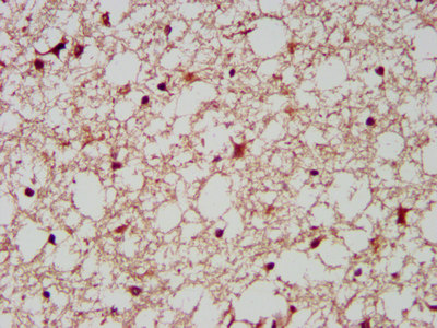 AIMP1 / EMAP II Antibody - Immunohistochemistry image at a dilution of 1:200 and staining in paraffin-embedded human brain tissue performed on a Leica BondTM system. After dewaxing and hydration, antigen retrieval was mediated by high pressure in a citrate buffer (pH 6.0) . Section was blocked with 10% normal goat serum 30min at RT. Then primary antibody (1% BSA) was incubated at 4 °C overnight. The primary is detected by a biotinylated secondary antibody and visualized using an HRP conjugated SP system.