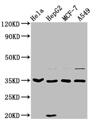 AIMP1 / EMAP II Antibody - Positive Western Blot detected in Hela whole cell lysate, HepG2 whole cell lysate, MCF-7 whole cell lysate, A549 whole cell lysate. All lanes: AIMP1 antibody at 3.7 µg/ml Secondary Goat polyclonal to rabbit IgG at 1/50000 dilution. Predicted band size: 35, 38 KDa. Observed band size: 35 KDa