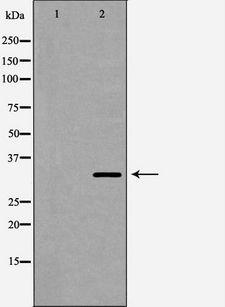 AIMP1 / EMAP II Antibody - Western blot analysis of HeLa whole cells lysates using AIMP1 antibody. The lane on the left is treated with the antigen-specific peptide.
