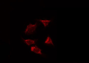 AIMP1 / EMAP II Antibody - Staining HeLa cells by IF/ICC. The samples were fixed with PFA and permeabilized in 0.1% Triton X-100, then blocked in 10% serum for 45 min at 25°C. The primary antibody was diluted at 1:200 and incubated with the sample for 1 hour at 37°C. An Alexa Fluor 594 conjugated goat anti-rabbit IgG (H+L) Ab, diluted at 1/600, was used as the secondary antibody.