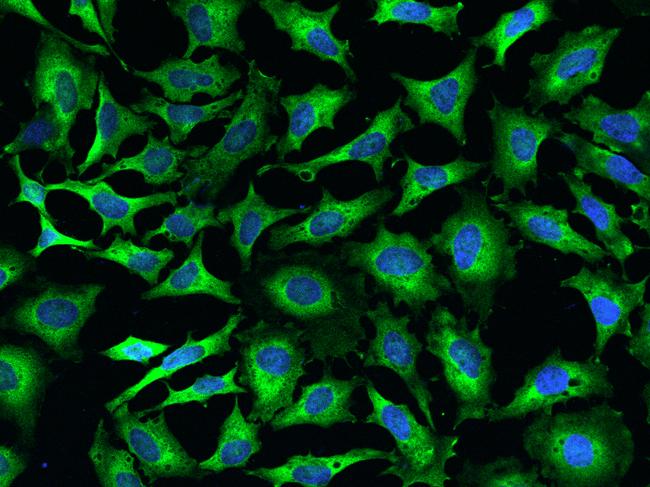 AIMP1 / EMAP II Antibody - Immunofluorescence staining of SCYE1 in HeLa cells. Cells were fixed with 4% PFA, permeabilzed with 0.1% Triton X-100 in PBS, blocked with 10% serum, and incubated with rabbit anti-Human SCYE1 polyclonal antibody (dilution ratio 1:500) at 4°C overnight. Then cells were stained with the Alexa Fluor 488-conjugated Goat Anti-rabbit IgG secondary antibody (green) and counterstained with DAPI (blue). Positive staining was localized to Cytoplasm.