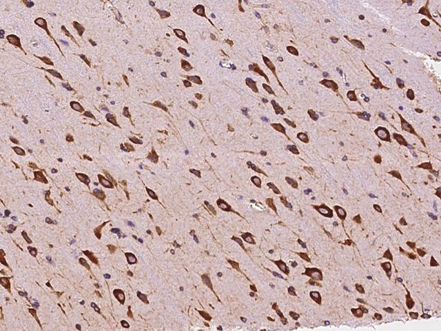 AIMP1 / EMAP II Antibody - Immunochemical staining of human SCYE1 in human brain with rabbit polyclonal antibody at 1:5000 dilution, formalin-fixed paraffin embedded sections.