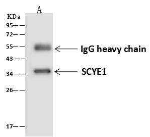 AIMP1 / EMAP II Antibody - SCYE1 was immunoprecipitated using: Lane A: 0.5 mg HepG2 Whole Cell Lysate. 4 uL anti-SCYE1 rabbit polyclonal antibody and 60 ug of Immunomagnetic beads Protein A/G. Primary antibody: Anti-SCYE1 rabbit polyclonal antibody, at 1:100 dilution. Secondary antibody: Goat Anti-Rabbit IgG (H+L)/HRP at 1/10000 dilution. Developed using the ECL technique. Performed under reducing conditions. Predicted band size: 35 kDa. Observed band size: 35 kDa.